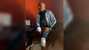 Sowore Injured In Ekiti, Receiving Treatment – Police